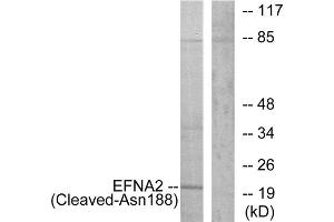 Western blot analysis of extracts from 293 cells, treated with etoposide (25uM, 1hour), using EFNA2 (Cleaved-Asn188) antibody. (Ephrin A2 antibody  (Cleaved-Asn188))