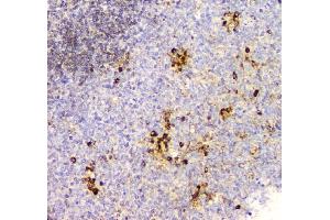 IHC analysis of Cyclophilin B using anti-Cyclophilin B antibody (ABIN6719475).