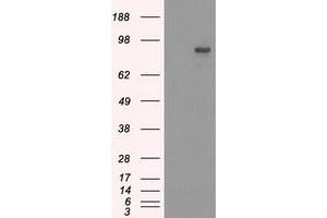 Western Blotting (WB) image for anti-SATB Homeobox 1 (SATB1) antibody (ABIN1500810) (SATB1 antibody)