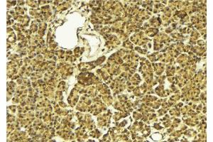 ABIN6274288 at 1/100 staining Mouse pancreas tissue by IHC-P. (LIMK2 antibody  (Internal Region))