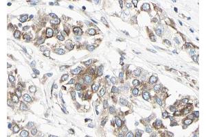 ABIN6267044 at 1/100 staining human Lung tissue sections by IHC-P. (NF-kB p65 antibody  (C-Term))