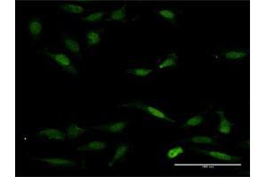 Immunofluorescence of purified MaxPab antibody to NFAT5 on HeLa cell. (NFAT5 antibody  (AA 1-1484))