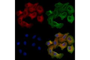 ABIN6257099 and ABIN6275623 staining Hela cells by IF/ICC. (CCT5 antibody  (Internal Region))