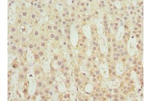 Immunohistochemistry of paraffin-embedded human adrenal gland tissue using ABIN7173754 at dilution of 1:100 (TBCE antibody  (AA 328-527))