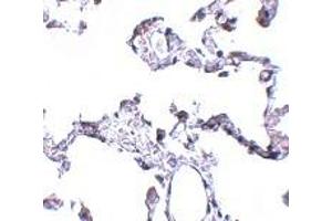 Immunohistochemistry (IHC) image for anti-CD81 (CD81) (N-Term) antibody (ABIN1031309) (CD81 antibody  (N-Term))