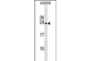 CHCHD6 Antibody (Center) (ABIN1537835 and ABIN2849408) western blot analysis in  cell line lysates (35 μg/lane). (CHCHD6 antibody  (AA 136-165))