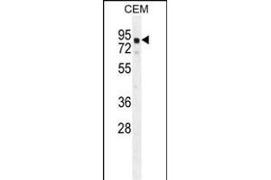 GLB1L2 Antibody (C-term) (ABIN654822 and ABIN2844495) western blot analysis in CEM cell line lysates (35 μg/lane). (GLB1L2 antibody  (C-Term))