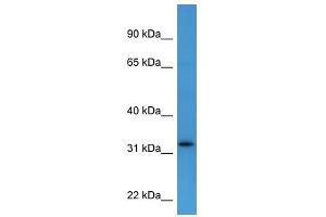 Western Blot showing DOK4 antibody used at a concentration of 1-2 ug/ml to detect its target protein.