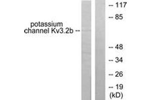 Western blot analysis of extracts from HepG2 cells, using Potassium Channel Kv3. (Kv3.2b Potassium Channel antibody  (AA 589-638))