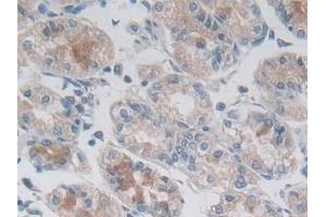 Immunohistochemistry (IHC) image for anti-Desmoplakin (DSP) (AA 2609-2822) antibody (ABIN7434746)