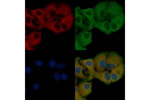 ABIN6257277 and ABIN6275882 staining Hela cells by IF/ICC. (IL-21 antibody  (Internal Region))