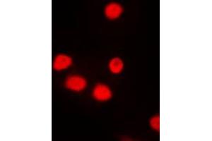 Immunofluorescent analysis of SIX6 staining in NIH3T3 cells. (SIX Homeobox 6 antibody  (Center))