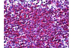 Anti-IL-16 antibody IHC of human spleen. (IL16 antibody)