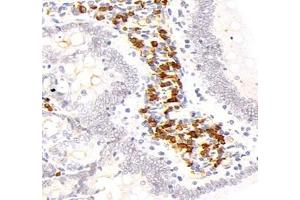 Immunohistochemistry analysis of paraffin-embedded mouse kidney using,STC (ABIN7075723) at dilution of 1: 800 (Stanniocalcin 1 antibody)