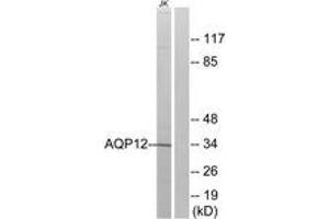 Western blot analysis of extracts from Jurkat cells, using AQP12 Antibody. (Aquaporin 12A antibody  (AA 231-280))