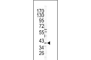 Western blot analysis of CATB Antibody (Center) (ABIN391549 and ABIN2841498) in Y79 cell line lysates (35 μg/lane). (Tyrosinase-Related Protein 1 antibody  (AA 198-227))