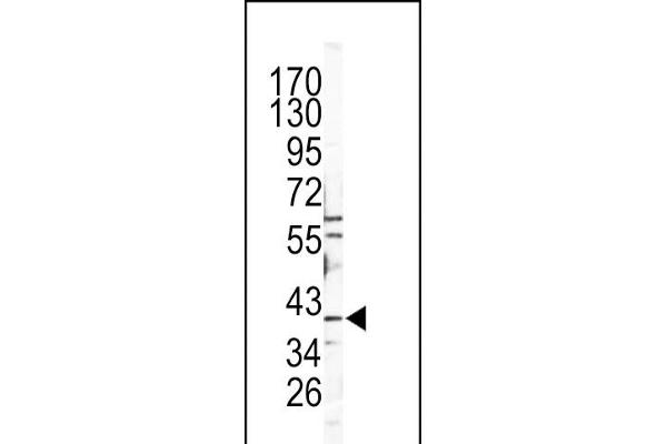 Tyrosinase-Related Protein 1 antibody  (AA 198-227)