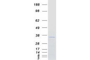Validation with Western Blot