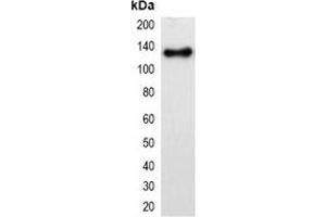 Western blot analysis of over-expressed mOrange-tagged protein in 293T cell lysate. (mOrange Fluorescent Protein antibody)