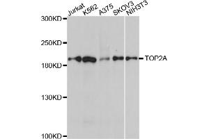 Western blot analysis of extracts of various cell lines, using TOP2A antibody (ABIN5970277) at 1/1000 dilution. (Topoisomerase II alpha antibody)