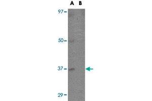 Western blot analysis of EBI3 in K-562 cell lysate with EBI3 polyclonal antibody  at 1 ug/mL in (A) the absence and (B) the presence of blocking peptide.