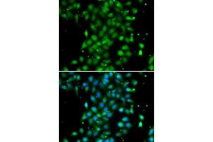 Immunofluorescence analysis of MCF-7 cells using UBE2Z antibody (ABIN5974351).