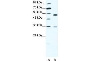 WB Suggested Anti-GDI1 Antibody Titration:  1. (GDI1 antibody  (C-Term))