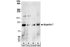anti-Exportin, tRNA (Nuclear Export Receptor For TRNAs) (XPOT) (AA 825-875) antibody