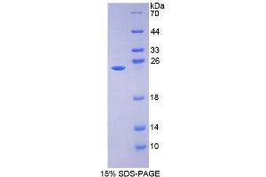 Image no. 1 for Hydroxysteroid (17-Beta) Dehydrogenase 10 (HSD17B10) (AA 4-202) protein (His tag) (ABIN4990363)