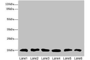 Western blot All lanes: CFL2 antibody at 3. (Cofilin 2 antibody  (AA 1-166))