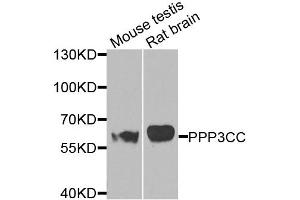Western blot analysis of extracts of various cell lines, using PPP3CC antibody (ABIN5975168) at 1/1000 dilution. (PPP3CC antibody)