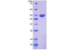 Image no. 1 for 17-Beta Hydroxysteroid Dehydrogenase Type 14 (HSD17b14) (AA 1-270) protein (T7 tag,His tag) (ABIN6237085)