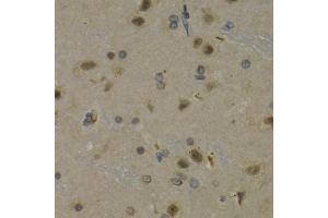 Immunohistochemistry of paraffin-embedded rat brain using MAX antibody (ABIN5971184) at dilution of 1/200 (40x lens). (MAX antibody)