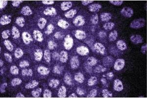Immunofluorescence staining of A431 cells (Human epithelial carcinoma, ATCC CRL-1555). (DDB1 antibody  (AA 739-935))