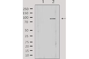 Western blot analysis of extracts from HepG2, using AKAP3 Antibody. (AKAP3 antibody  (Internal Region))