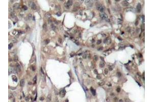 Image no. 3 for anti-V-Akt Murine Thymoma Viral Oncogene Homolog 1 (AKT1) antibody (ABIN265302) (AKT1 antibody)
