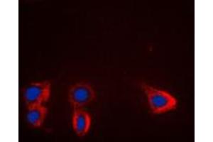 Immunofluorescent analysis of TRK B staining in HL60 cells. (TRKB antibody  (Center))