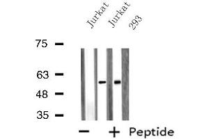 Western blot analysis of extracts from Jurkat/293 cells, using SNX1 antibody. (Sorting Nexin 1 antibody  (Internal Region))