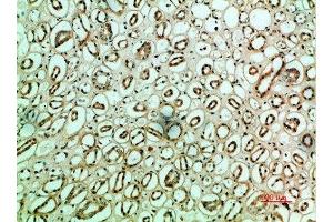 Immunohistochemical analysis of paraffin-embedded human-kidney, antibody was diluted at 1:200 (Fibronectin 1 antibody  (AA 1268-1341))