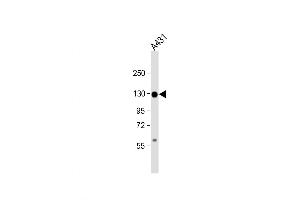 Western Blot at 1:1000 dilution + A431 whole cell lysate Lysates/proteins at 20 ug per lane. (P-Cadherin antibody  (N-Term))