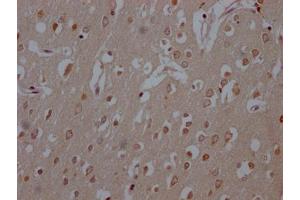 IHC image of ABIN7127433 diluted at 1:100 and staining in paraffin-embedded human brain tissue performed on a Leica BondTM system. (Recombinant COMT antibody)