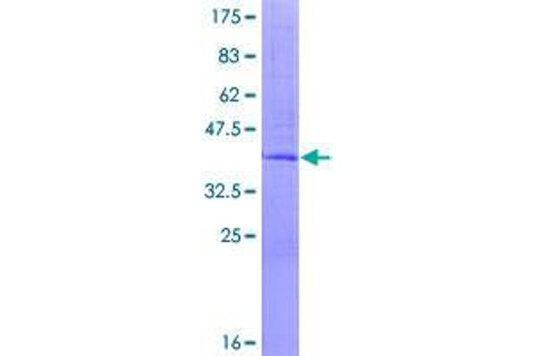 EDEM3 Protein (AA 1-122) (GST tag)