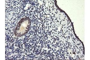 Image no. 3 for anti-SEC14 and Spectrin Domains 1 (SESTD1) antibody (ABIN1501066) (SESTD1 antibody)