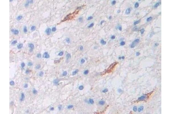 Permeability Glycoprotein antibody  (AA 394-672)