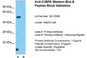 Host: Rabbit  Target Name: C4BPA  Sample Tissue: HepG2 Whole Cell  Lane A:  Primary Antibody Lane B:  Primary Antibody + Blocking Peptide Primary Antibody Concentration: 1 µg/mL Peptide Concentration: 5 µg/mL Lysate Quantity: 41 µg/laneGel Concentration:. (C4BPA antibody  (Middle Region))