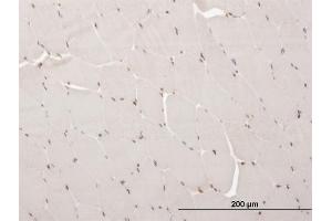 Immunoperoxidase of monoclonal antibody to ARX on formalin-fixed paraffin-embedded human skeletal muscle. (Arx antibody  (AA 1-95))