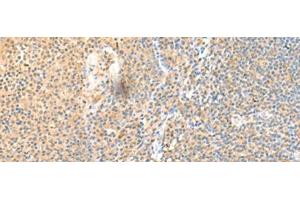 Immunohistochemistry of paraffin-embedded Human tonsil tissue using SSC4D Polyclonal Antibody at dilution of 1:70(x200) (SRCRB4D antibody)