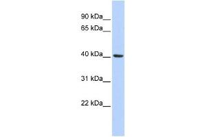INSIG1 antibody used at 1 ug/ml to detect target protein. (INSIG1 antibody  (Middle Region))