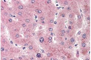 Human Liver (formalin-fixed, paraffin-embedded) stained with CYP2E1 antibody ABIN301632 at 20 ug/ml followed by biotinylated goat anti-rabbit IgG secondary antibody ABIN481713, alkaline phosphatase-streptavidin and chromogen. (CYP2E1 antibody  (C-Term))