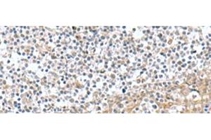 Immunohistochemistry of paraffin-embedded Human tonsil tissue using TNNC2 Polyclonal Antibody at dilution of 1:50(x200) (TNNC2 antibody)